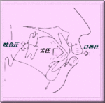 矯正歯科/筋肉療法図１