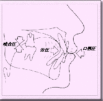 矯正歯科/筋肉療法図２